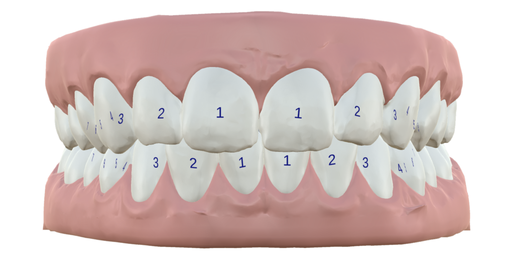 Digital Smile Planning - Setups