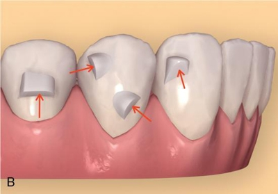 Digital Smile Planning